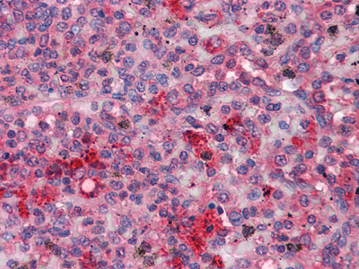 Immunohistochemistry analysis of paraffin-embedded human Spleen tissues with AEC staining using c-Fgr monoclonal antibody.