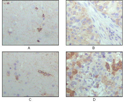 Immunohistochemistry analysis of paraffin-embedded human brain hippocampus (A) , lung cancer (B) , brain tumor (C) , breast cance (D) , showing cytoplasmic localization with DAB staining using Crystallin-Alpha B monoclonal antibody.