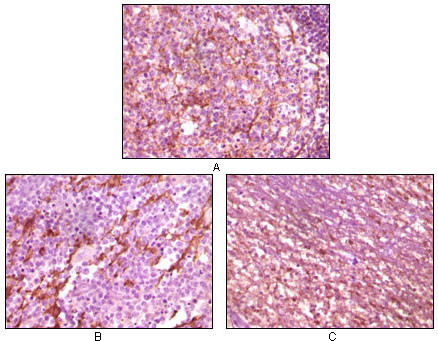 Immunohistochemistry analysis of paraffin-embedded human lymph tissue (A) , glioma tissue (B) and cerebellum tissue (C) , showing membrane localization with DAB staining using Dynamin I monoclonal antibody.