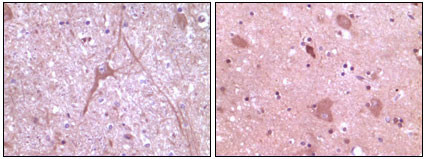 Immunohistochemistry analysis of paraffin-embedded human cerebrum tissue (left) and myelencephalon tissue (right) , showing cytoplasmic localization with DAB staining using Dynamin II monoclonal antibody.