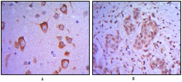 Immunohistochemistry analysis of paraffin-embedded human brain tissue (A) and breast tumor (B) with AEC staining using ETS1 monoclonal antibody.
