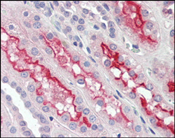 Immunohistochemistry analysis of paraffin-embedded human kidney tissues with AEC staining using Fer monoclonal antibody.