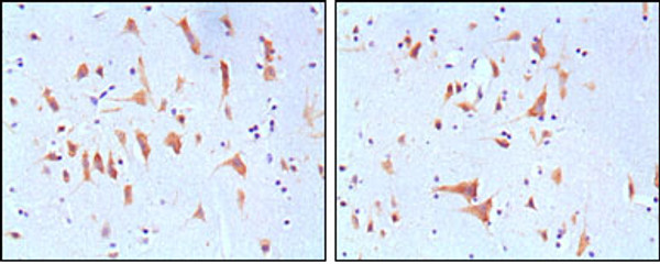Immunohistochemistry analysis of paraffin-embedded human brain tissues, showing cytoplasmic localization with DAB staining using FMR1 monoclonal antibody.