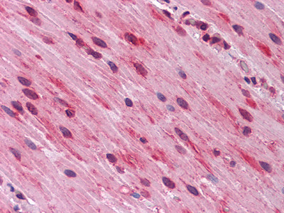 Immunohistochemistry analysis of paraffin-embedded human Small Intestine, muscularis propria tissues with AEC staining using GATA-3 monoclonal antibody.