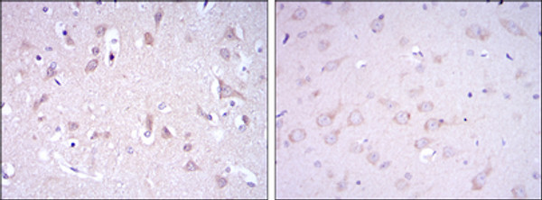 Immunohistochemistry analysis of paraffin-embedded human brain tissues (left) and rat brain tissues (right) with DAB staining using GluR-3 monoclonal antibody. Immunohistochemistry analysis of paraffin-embedded human brain tissues (left) and rat brain tissues (right) with DAB staining using GluR-3 monoclonal antibody.