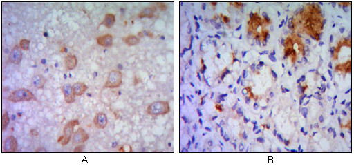 Immunohistochemistry analysis of paraffin-embedded human brain tissue (A) and stomach tissue (B) , showing cytoplasmic localization with DAB staining using IRE1 Alpha monoclonal antibody.