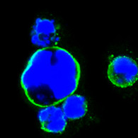 Confocal immunofluorescence analysis of HEK293 cells trasfected with full-length Islet-1-hIgGFc using Islet-1 monoclonal antibody (green). Blue: DRAQ5 fluorescent DNA dye.