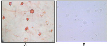 Immunocytochemistry analysis of TPA induced BCBL-1 cells (A) and uninduced BCBL-1 cells (B) using KSHV K8 Alpha monoclonal antibody with AEC staining.
