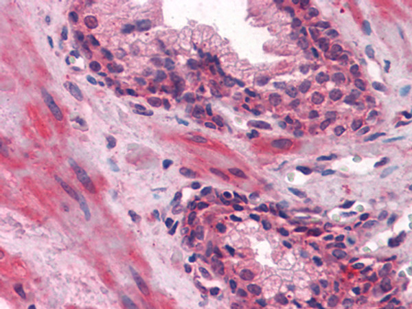 Immunohistochemistry analysis of paraffin-embedded human Prostate tissues with AEC staining using Lipocalin-1 monoclonal antibody.