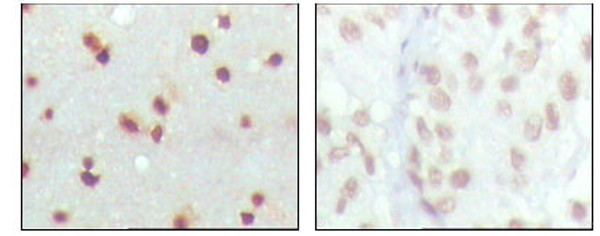 Immunohistochemistry analysis of paraffin-embedded human cerebra (left) and lung carcinoma (right) tissues, showing nuclear localization with DAB staining using MDMX monoclonal antibody.