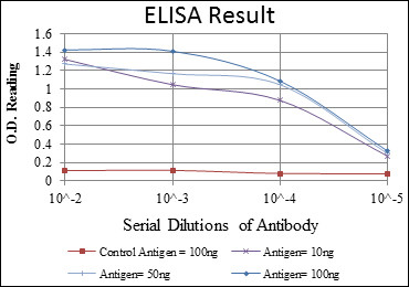 Anti-MMP1 antibody [6A5] (STJ98247)