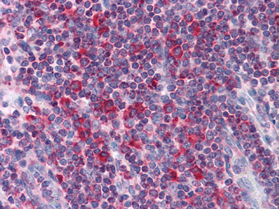 Immunohistochemistry analysis of paraffin-embedded human Liver tissues with AEC staining using MTDH monoclonal antibody.