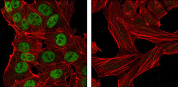 Confocal immunofluorescence analysis of NTERA-2 cells (left) and HeLa cells (right) using Nanog monoclonal antibody (green). Red: Actin filaments have been labeled with DY-554 phalloidin.
