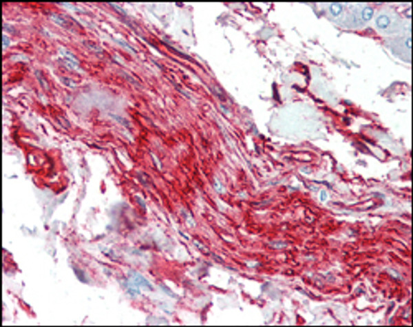 Immunohistochemistry analysis of paraffin-embedded human nerve and ganglion cells with AEC staining using S-100A10 monoclonal antibody. Immunohistochemistry analysis of paraffin-embedded human nerve and ganglion cells with AEC staining using S-100A10 monoclonal antibody.