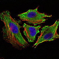 Immunofluorescence analysis of Hela cells using Stat6 monoclonal antibody (green). Blue: DRAQ5 fluorescent DNA dye. Red: Actin filaments have been labeled with Alexa Fluor-555 phalloidin.