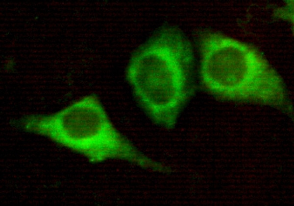 Immunofluorescence analysis of HeLa cells using Cytokeratin 7 monoclonal antibody.