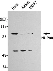 Western blot analysis using Nup98 monoclonal antibody against HeLa, Jurkat, and MCF7 cell lysates. STJ98522