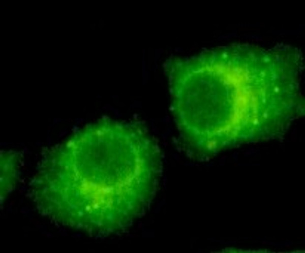 Immunofluorescence analysis of HeLa cells using Rab 2A monoclonal antibody. Immunofluorescence analysis of HeLa cells using Rab 2A monoclonal antibody.