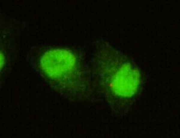Immunofluorescence analysis of HeLa cells using SmcX monoclonal antibody.
