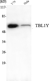 Western blot analysis using TBL1Y monoclonal antibody against Y79, HeLa cell lysate.