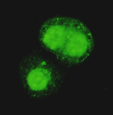 Immunocytochemistry staining of HeLa cells fixed with 4% Paraformaldehyde and using anti-KAP1/TIF1 beta mouse mAb (dilution 1:100).