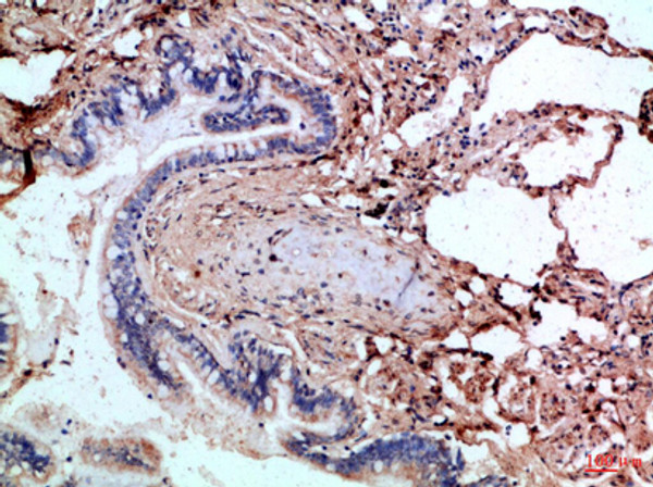 Immunohistochemical analysis of paraffin-embedded Human-lung, antibody was diluted at 1:100