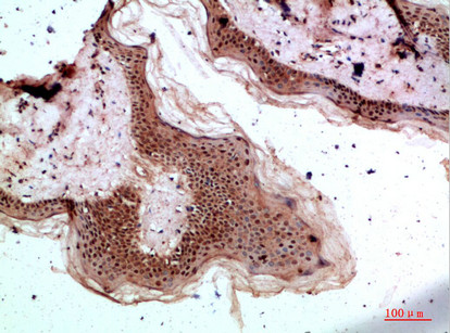 Immunohistochemical analysis of paraffin-embedded human-skin, antibody was diluted at 1:200