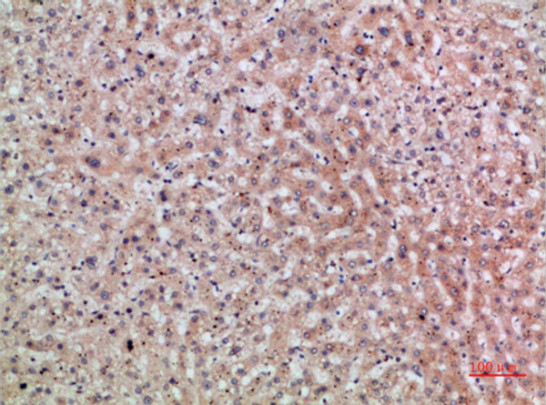 Immunohistochemical analysis of paraffin-embedded human-liver, antibody was diluted at 1:200