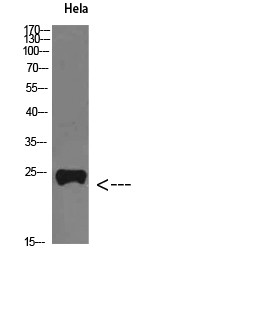 Western blot analysis of HeLa cells using PTH-rP polyclonal antibody diluted at 1:800. Secondary antibody (catalog#: STJ98621