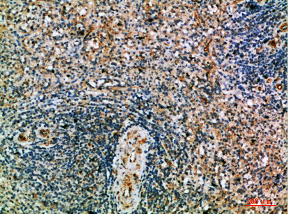 Immunohistochemical analysis of paraffin-embedded human-spleen, antibody was diluted at 1:200