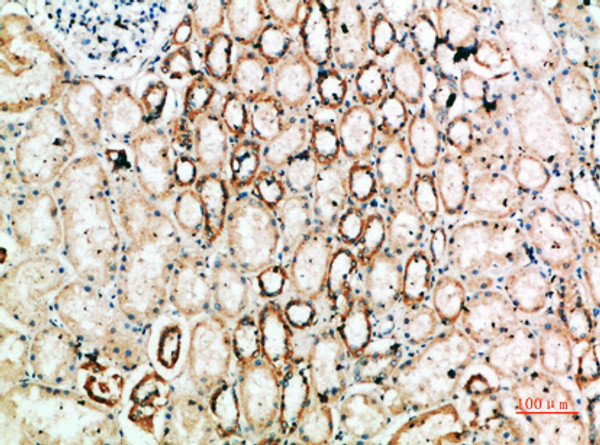 Immunohistochemical analysis of paraffin-embedded human-kidney, antibody was diluted at 1:200