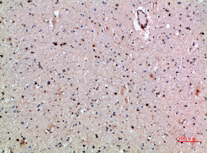 Immunohistochemical analysis of paraffin-embedded human-brain, antibody was diluted at 1:200