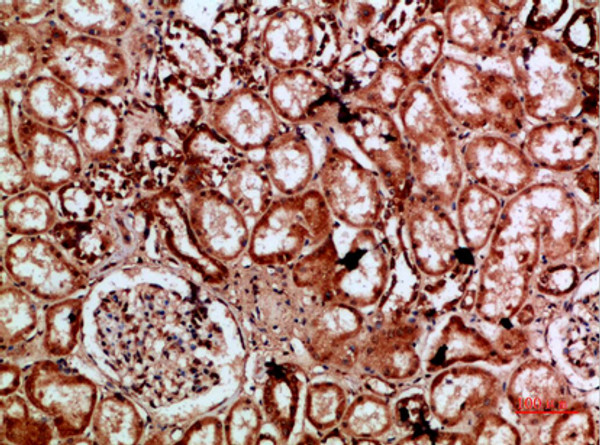 Immunohistochemical analysis of paraffin-embedded human-kidney, antibody was diluted at 1:200