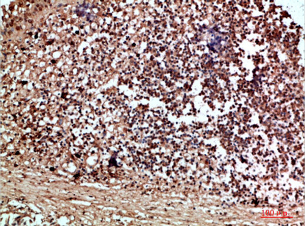 Immunohistochemical analysis of paraffin-embedded human-thyroid, antibody was diluted at 1:200