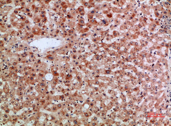 Immunohistochemical analysis of paraffin-embedded human-liver, antibody was diluted at 1:200