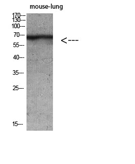Western blot analysis of mouse lung, mouse brain, mouse kidney, and mouse heart lysates. Antibody was diluted at 1:500. STJ98693
