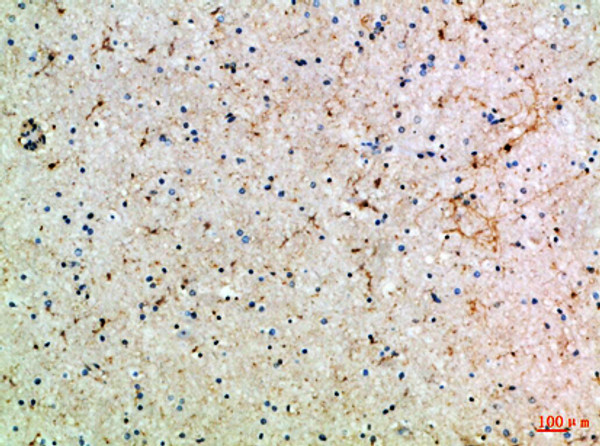 Immunohistochemical analysis of paraffin-embedded Human-brain, antibody was diluted at 1:100