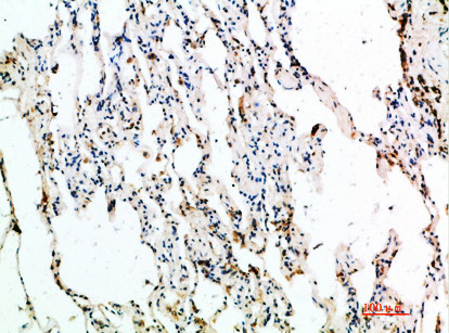 Immunohistochemical analysis of paraffin-embedded human-lung, antibody was diluted at 1:200