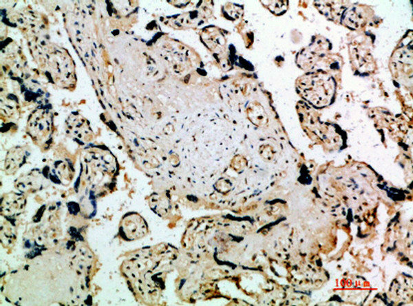 Immunohistochemical analysis of paraffin-embedded human-placenta, antibody was diluted at 1:200