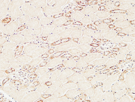 Immunohistochemical analysis of paraffin-embedded Human kidney. 1, Antibody was diluted at 1:200 (4°C overnight). 2, High-pressure and temperature EDTA, pH8.0 was used for antigen retrieval. 3, Secondary antibody was diluted at 1:200 (room temperature, 30min).