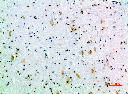 Immunohistochemical analysis of paraffin-embedded human-brain, antibody was diluted at 1:200