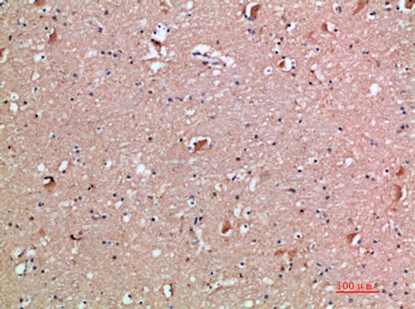 Immunohistochemical analysis of paraffin-embedded human-brain, antibody was diluted at 1:200