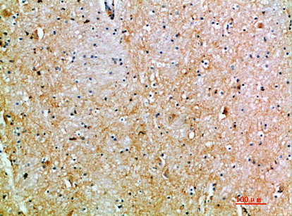 Immunohistochemical analysis of paraffin-embedded human-brain, antibody was diluted at 1:200