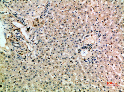 Immunohistochemical analysis of paraffin-embedded human-liver, antibody was diluted at 1:200