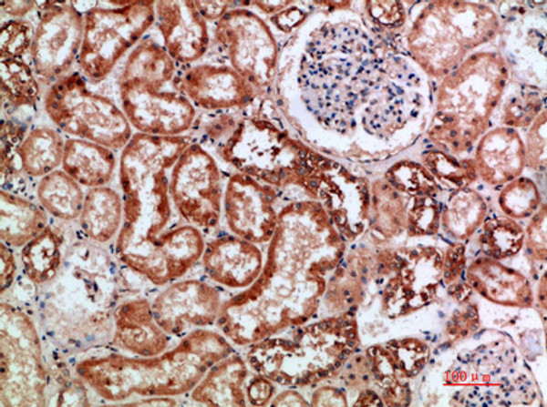 Immunohistochemical analysis of paraffin-embedded human-kidney, antibody was diluted at 1:200 Immunohistochemical analysis of paraffin-embedded human-kidney, antibody was diluted at 1:200