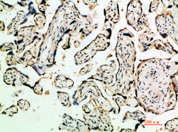 Immunohistochemical analysis of paraffin-embedded human-placenta, antibody was diluted at 1:200