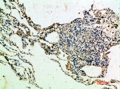 Immunohistochemical analysis of paraffin-embedded human-lung, antibody was diluted at 1:200