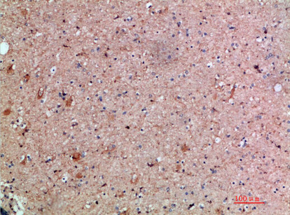 Immunohistochemical analysis of paraffin-embedded human-brain, antibody was diluted at 1:200