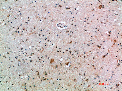 Immunohistochemical analysis of paraffin-embedded human-brain, antibody was diluted at 1:200