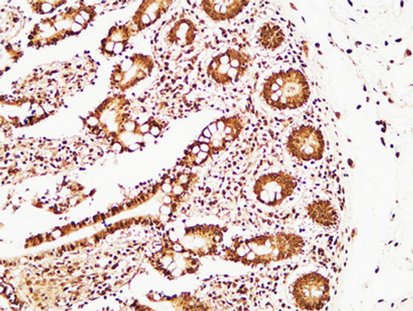 Immunohistochemical analysis of paraffin-embedded Human colon. 1, Antibody was diluted at 1:200 (4°C overnight). 2, High-pressure and temperature EDTA, pH8.0 was used for antigen retrieval. 3, Secondary antibody was diluted at 1:200 (room temperature, 30min).